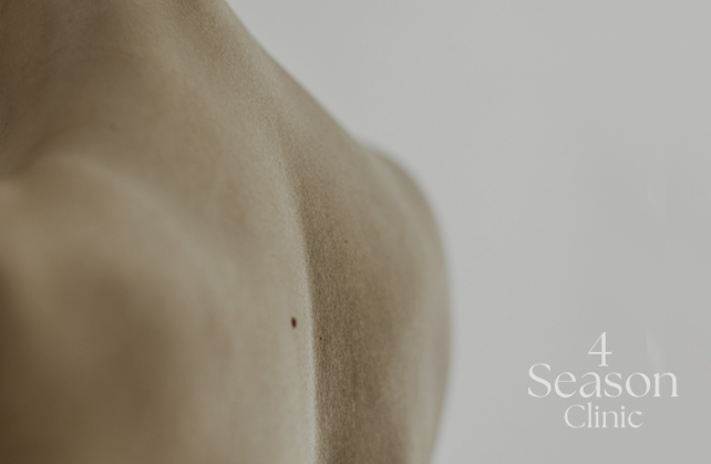 포시즌의원 등︱가슴 여드름 치료